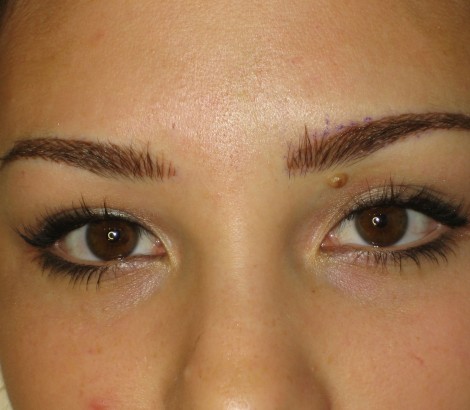 Cosmetic Tattooing Kelowna immediately after eyebrows