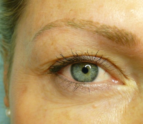 Permanent Makeup Kelowna before eyebrow procedure