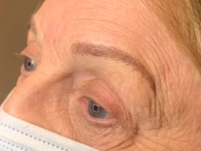 Micropigmentation after eyebrow procedure