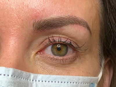 Micropigmentation after eyebrow procedure