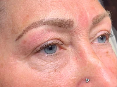 Micropigmentation after eyebrow procedure