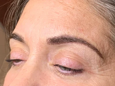 Micropigmentation after eyebrow procedure