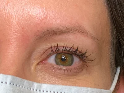 Micropigmentation before eyebrow procedure