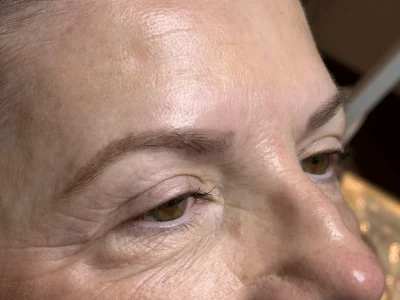 Micropigmentation before eyebrow procedure