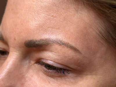 Micropigmentation healed eyebrow procedure