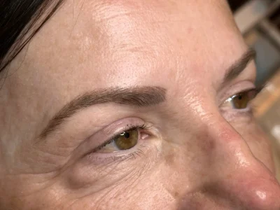 Micropigmentation healed eyebrow procedure