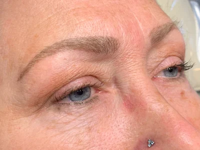 Micropigmentation healed eyebrow procedure