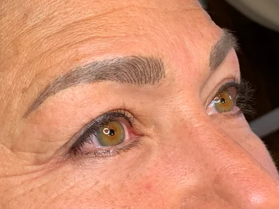 Micropigmentation healed eyebrow procedure