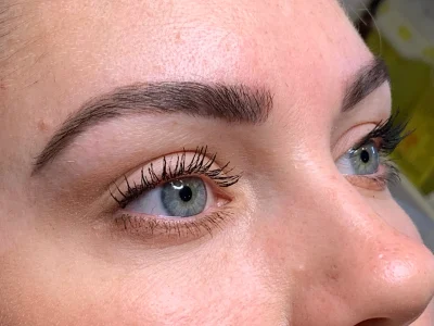 Micropigmentation healed eyebrow procedure