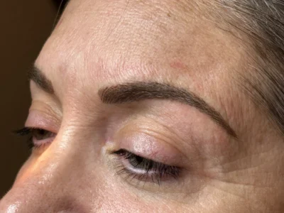 Micropigmentation healed eyebrow procedure