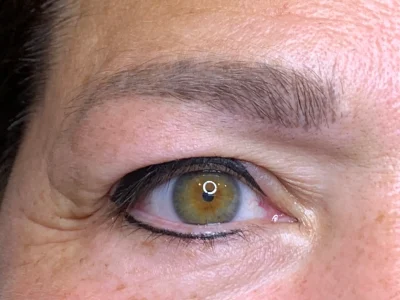 Micropigmentation after eyeliner procedure