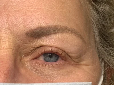 Micropigmentation before eyeliner procedure