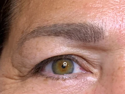 Micropigmentation before eyeliner procedure