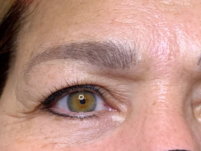 Micropigmentation healed eyeliner procedure